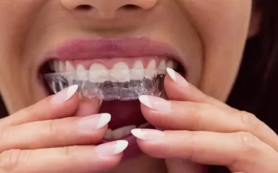 Invisalign Cincinnati: Clear Aligner Therapy for Discreet Orthodontic Correction